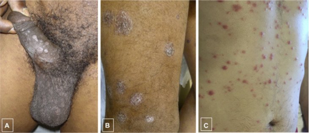 SAY NO TO UNPROTECTED SEX