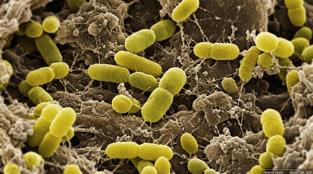 The Irkutsk Plague Scare: What We Know, and How AI Could Help Close the Gap